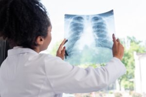 Blurred african american doctor holding fluorography in clinic